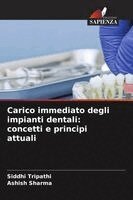 Carico immediato degli impianti dentali