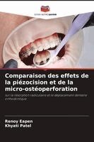Renoy Eapen, Khyati Patel - Comparaison des effets de la piézocision et de la micro-ostéoperforation, Häftad. Tillgänglighet: Lägg i varukorg