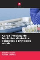 Carga imediata de implantes dentários