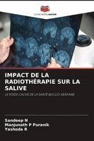 Sandeep N, Manjunath P Puranik, Yashoda R - Impact de la Radiothérapie Sur La Salive, Häftad. Tillgänglighet: Lägg i varukorg
