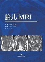 Fetal MRI/胎儿MRI