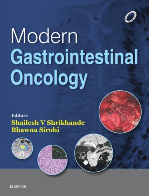 Bhawna Sirohi, Shailesh V Shrikhande - Modern GI Oncology - E-Book, E-bok