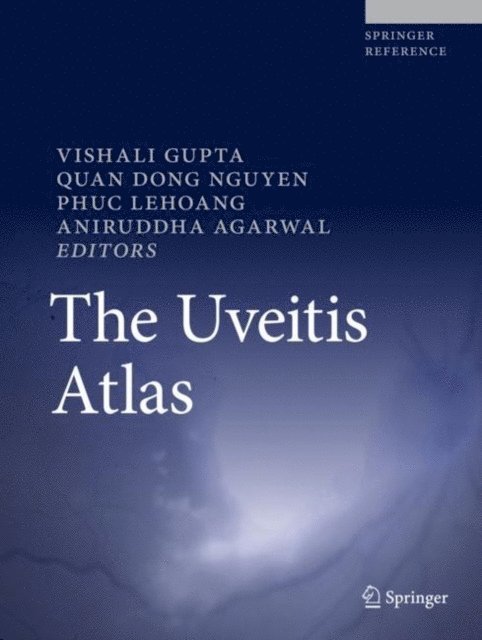 Aniruddha Agarwal, Phuc LeHoang, Quan Dong Nguyen, Vishali Gupta - Uveitis Atlas, E-bok