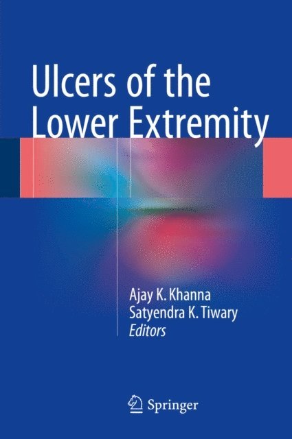Satyendra K Tiwary, Ajay K Khanna - Ulcers of the Lower Extremity, E-bok. Tillgänglighet: Lägg i varukorg