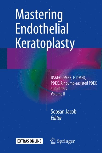 Soosan Jacob - Mastering Endothelial Keratoplasty, E-bok