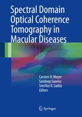 Spectral Domain Optical Coherence Tomography in Macular Diseases