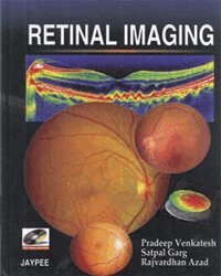 Pradeep Venkatesh, Satpal Garg, Raj Vardhan Azad - Retinal Imaging, Häftad. Tillgänglighet: Tillfälligt slut