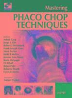 Mastering Phaco Chop Techniques