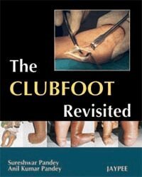 Sureshwar Pandey, Anil Kumar Pandey - Club Foot Revisited, Häftad