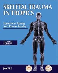 Sureshwar Pandey - Skeletal Trauma in Tropics, Häftad