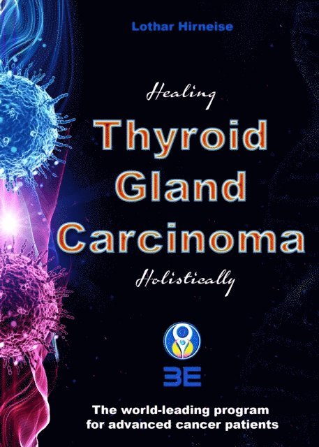 Lothar Hirneise - Thyroid Gland Carcinoma, E-bok