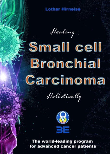 Lothar Hirneise - Small cell bronchial carcinoma, E-bok