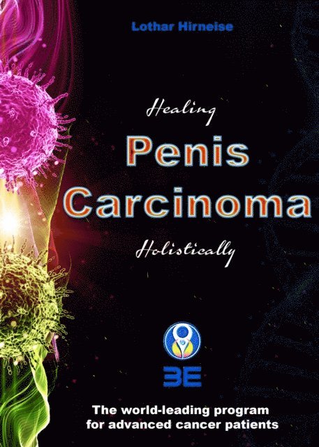 Lothar Hirneise - Penis carcinoma, E-bok