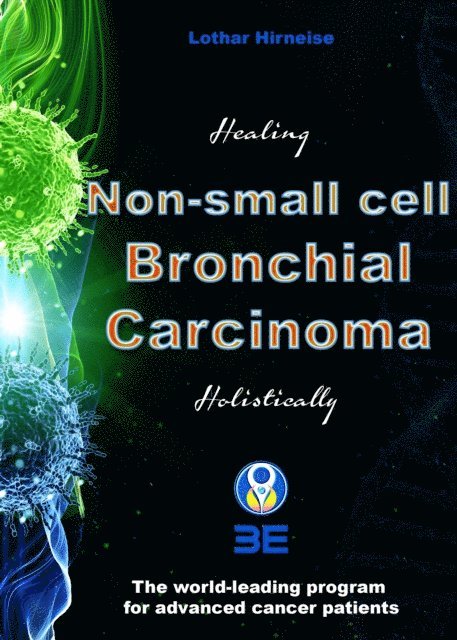 Lothar Hirneise - Non-small Cell Bronchial Carcinoma, E-bok