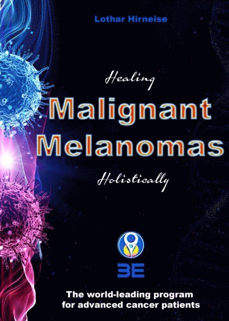 Lothar Hirneise - Malignant Melanomas, E-bok
