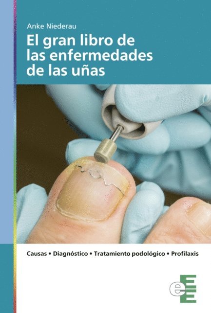 Anke Niederau - El gran libro de las enfermedades de las uñas, E-bok