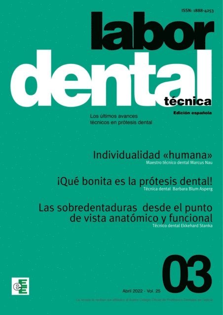 Ediciones Especializadas Europeas,s.l. - Labor Dental Técnica Nº3 Vol.25, E-bok