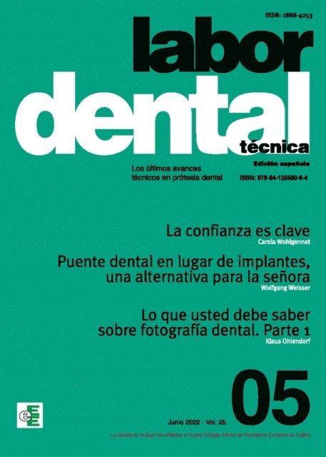 Ediciones Especializadas Europeas,s.l. - Labor Dental Técnica Nº5 Vol.25, E-bok