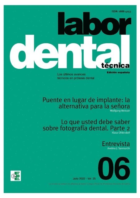 Ediciones Especializadas Europeas,s.l. - Labor Dental Técnica Nº6 Vol.25, E-bok