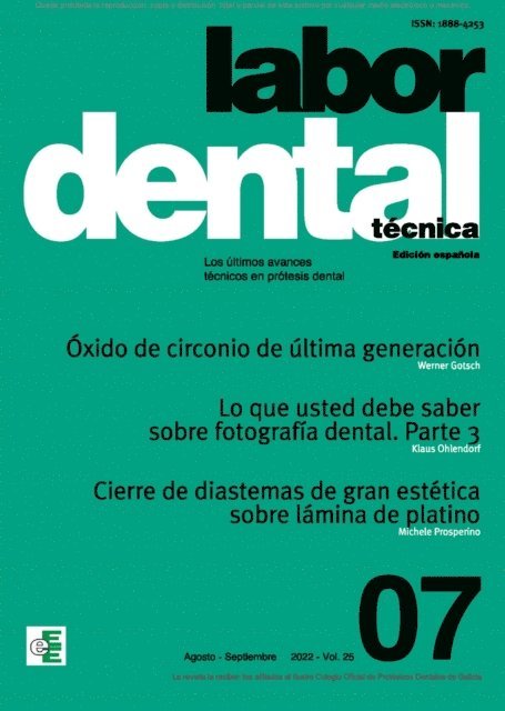 Ediciones Especializadas Europeas,s.l. - Labor Dental Técnica Nº7 Vol.25, E-bok