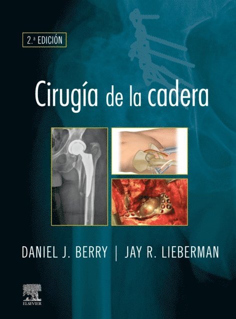 Jay Lieberman, Daniel J. Berry - Cirugía de la cadera, E-bok