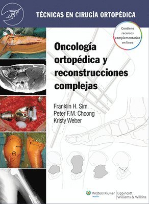 Franklin H. Sim, Peter F. M. Choong, Kristy L. Weber - Técnicas en cirugía ortopédica. Oncología ortopédica y reconstrucciones complejas, Inbunden. Tillgänglighet: Tillfälligt slut