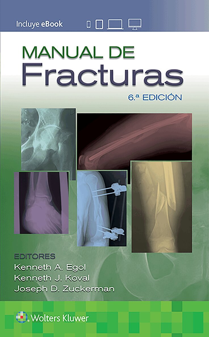 Kenneth Egol - Manual de fracturas, Häftad. Tillgänglighet: Tillfälligt slut