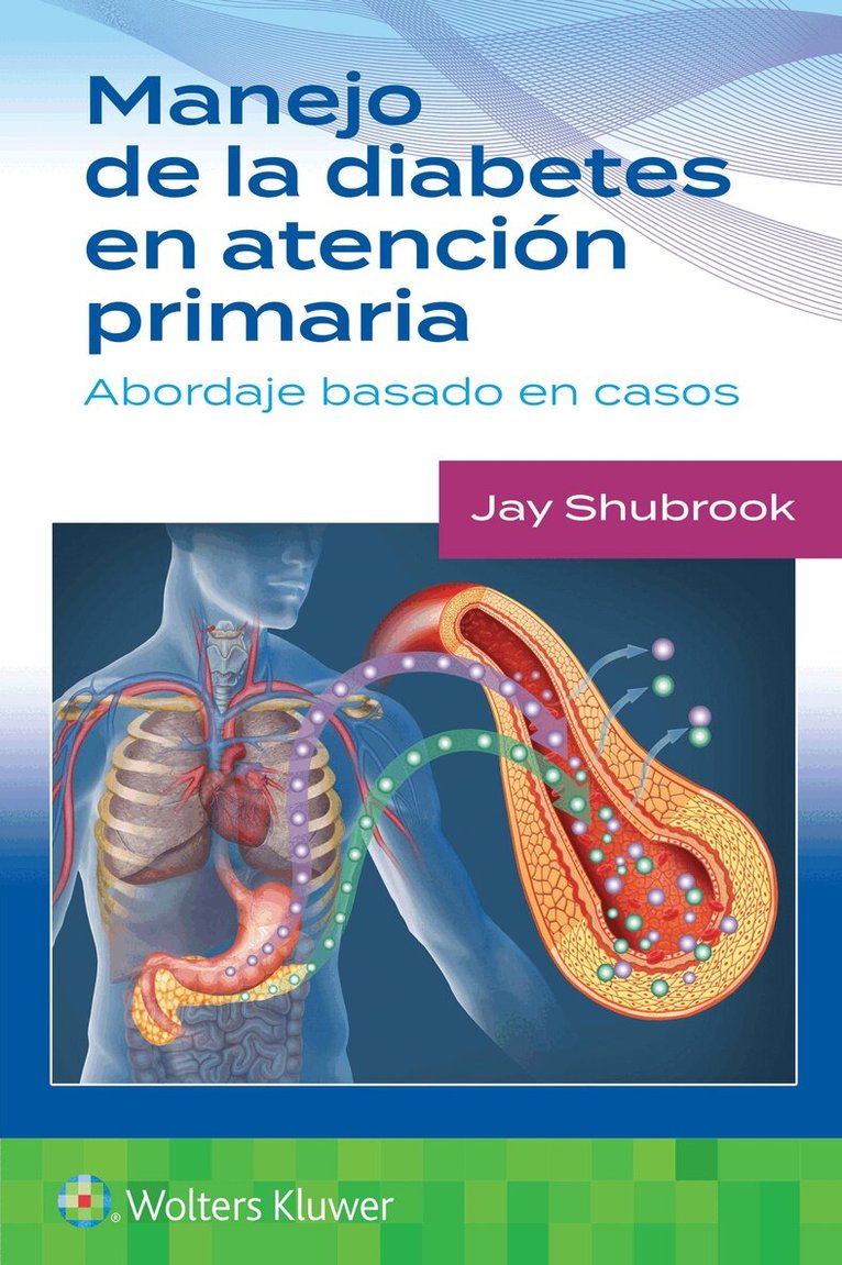 Jay H. Shubrook - Manejo de la diabetes en Atención primaria. Abordaje basado en casos, Häftad. Tillgänglighet: Lägg i varukorg