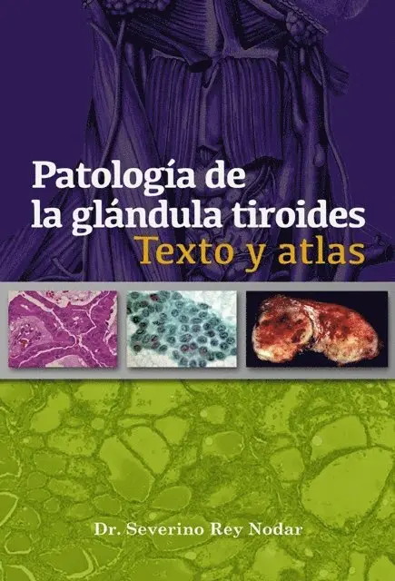 Severino Rey Nodar - Patología de la glándula tiroides, E-bok. Tillgänglighet: Lägg i varukorg