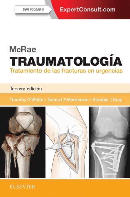 Alasdair J Gray, Samuel P Mackenzie, Timothy O White - McRae. Traumatología. Tratamiento de las fracturas en urgencias, E-bok