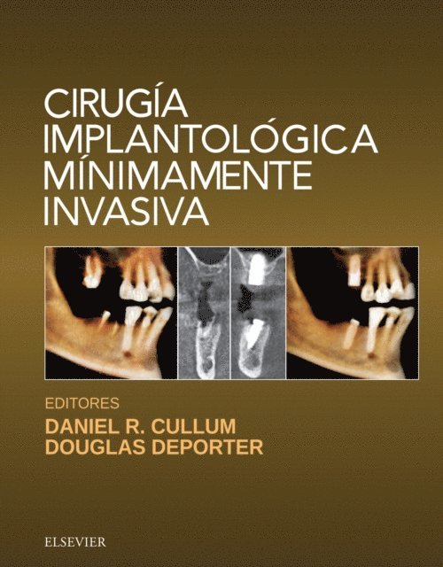 Douglas Deporter, Daniel R. Cullum - Cirugía implantológica mínimamente invasiva, E-bok