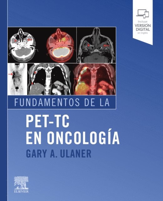 Gary A. Ulaner - Fundamentos de la PET-TC en oncología, E-bok