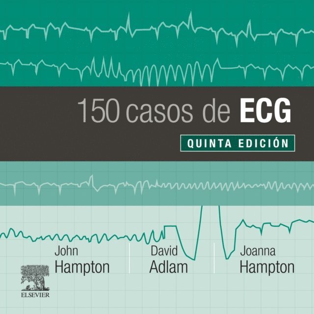Joanna Hampton, David Adlam, John Hampton - 150 casos de ECG, E-bok