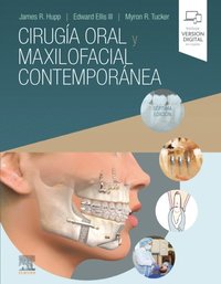 Contemporary Oral and Maxillofacial Surgery - James R Hupp