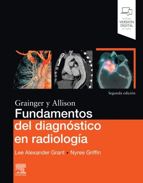 Nyree Griffin, Lee A. Grant - Fundamentos del diagnóstico en radiología, E-bok