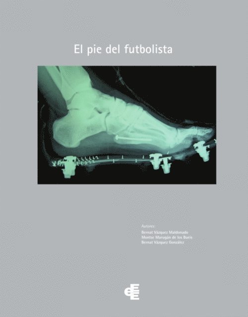 Bernat Vazquez Gonzalez, Montse Marugan de los Bueyes, Bernat Vazquez Maldonado - El pie del futbolista, E-bok