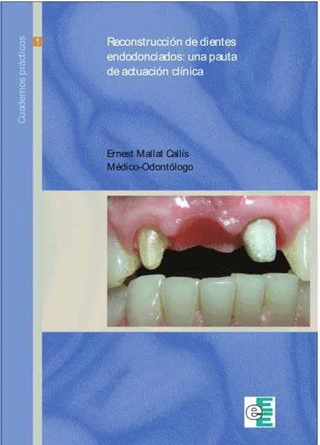 Ernest Mallat Callis - Reconstrucción de dientes endodonciados, E-bok