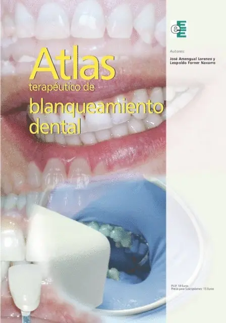 Jose Amengual Lorenzo - Atlas terapéutico de blanqueamiento dental, E-bok. Tillgänglighet: Lägg i varukorg