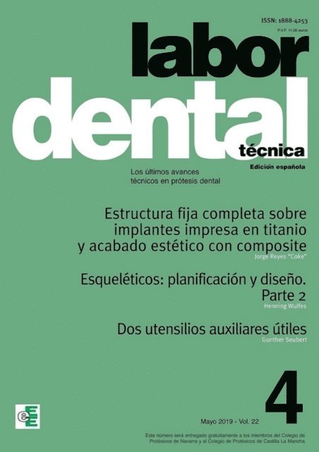 Varios autores - Labor Dental Técnica Vol.22 Mayo 2019 nº4, E-bok