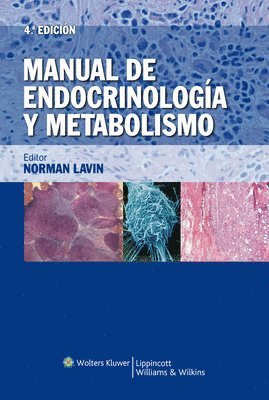 Norman Lavin - Manual de endocrinología y metabolismo. Tillgänglighet: Tillfälligt slut