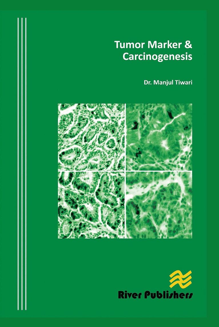 Manjul Tiwari - Tumor Marker and Carcinogenesis, Häftad. Tillgänglighet: Lägg i varukorg