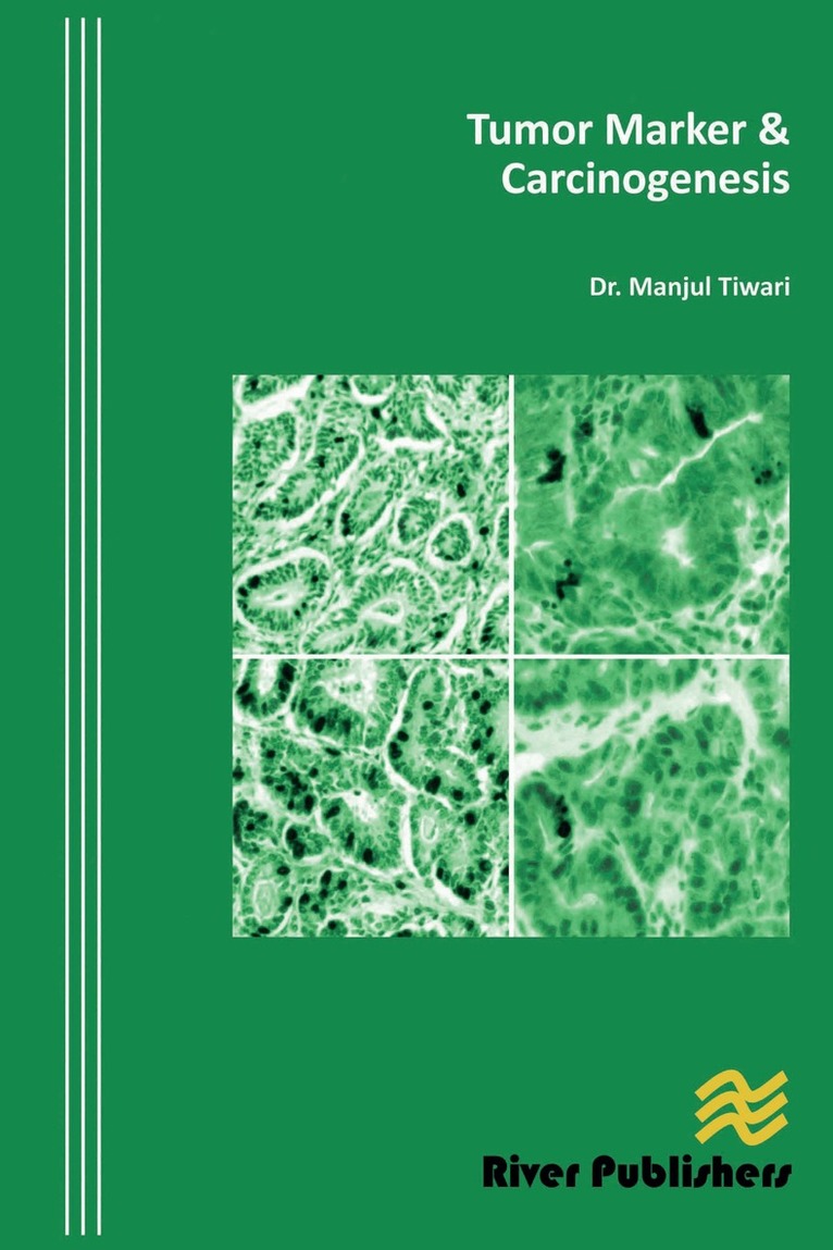 Manjul Tiwari - Tumor Marker and Carcinogenesis, Inbunden. Tillgänglighet: Lägg i varukorg
