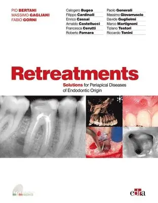 Pio Bertani, Massimo Gagliani, Fabio Gorni - Retreatment. Solutions for apical diseases of endodontic origin, Inbunden. Tillgänglighet: Lägg i varukorg