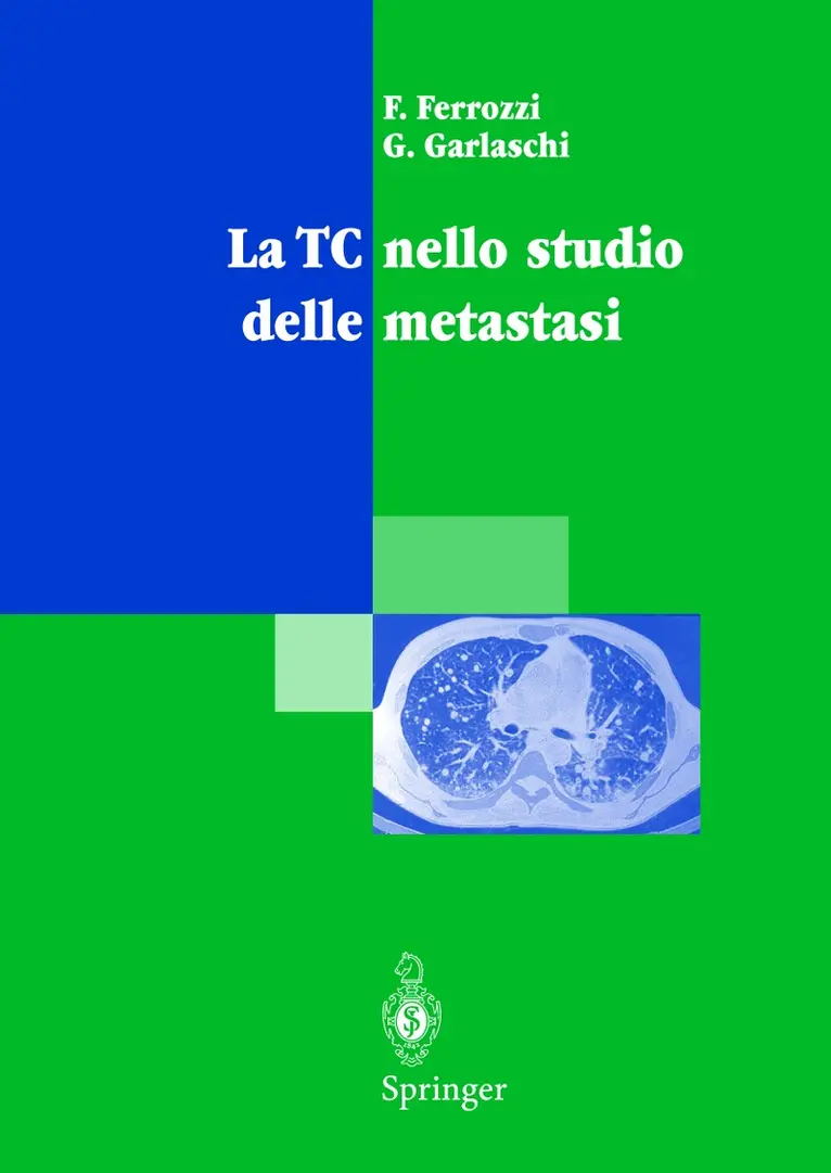 F. Ferrozzi, G. Garlaschi - La TC nello studio delle metastasi, Inbunden. Tillgänglighet: Lägg i varukorg