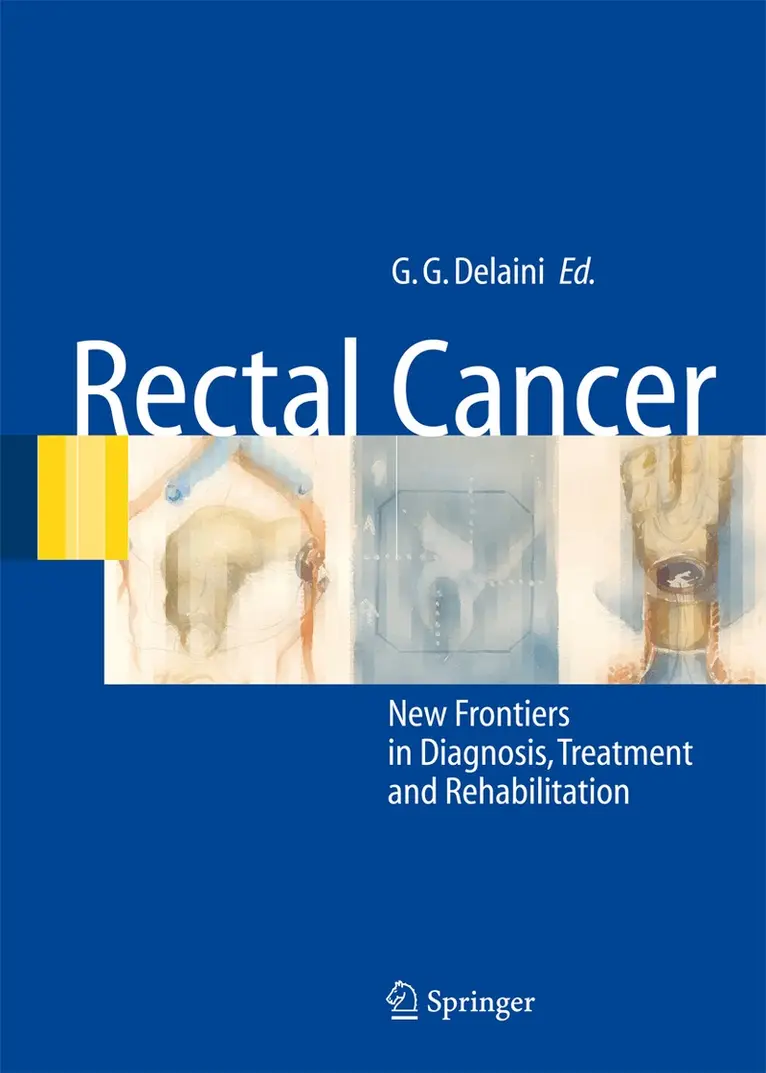 Gian Gaetano Delaini - Rectal Cancer, Inbunden. Tillgänglighet: Lägg i varukorg