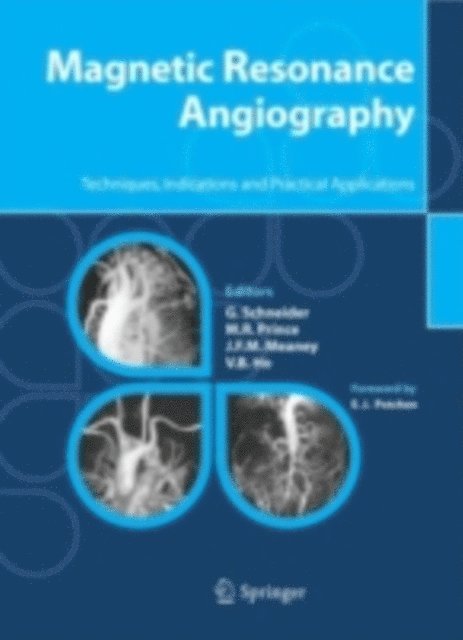 V.B. Ho, J.F.M. Meaney, M.R. Prince, G. Schneider - Magnetic Resonance Angiography, E-bok