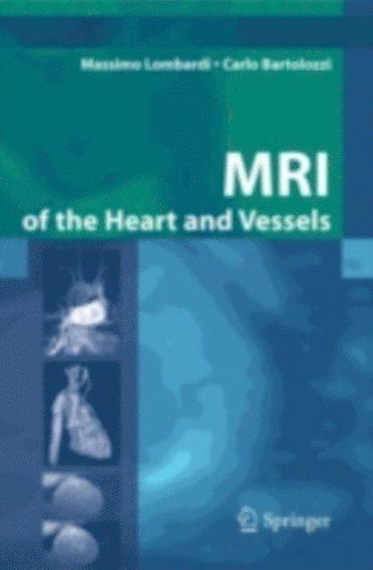 Carlo Bartolozzi, Massimo Lombardi - MRI of the Heart and Vessels, E-bok