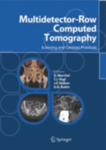 G. D. Rubin, J P. Heiken, T.J. Vogl, G. Marchal - Multidetector-Row Computed Tomography, E-bok