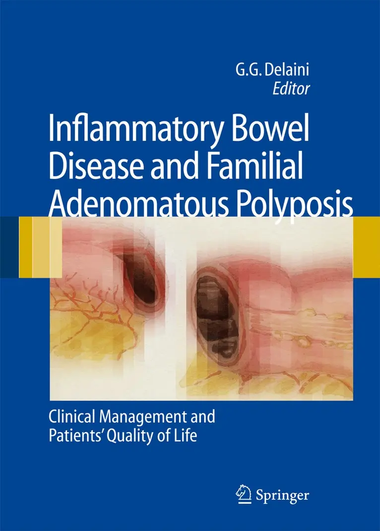 Gian Gaetano Delaini - Inflammatory Bowel Disease and Familial Adenomatous Polyposis, Inbunden. Tillgänglighet: Lägg i varukorg