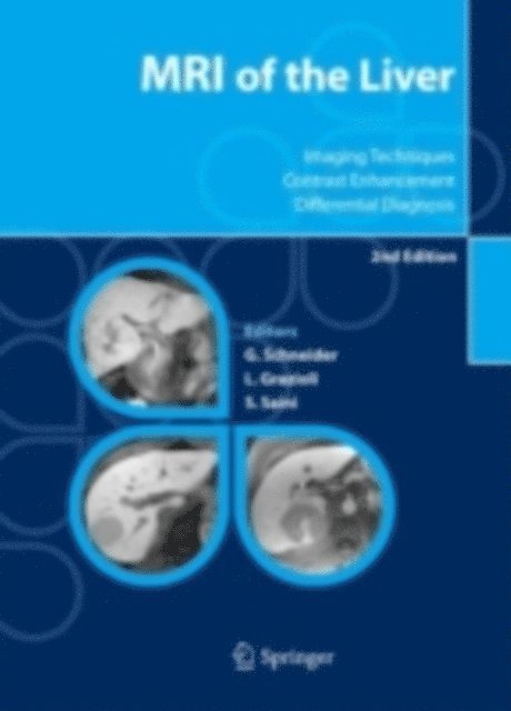 Sanjay Saini, Luigi Grazioli, Gunther Schneider - MRI of the Liver, E-bok